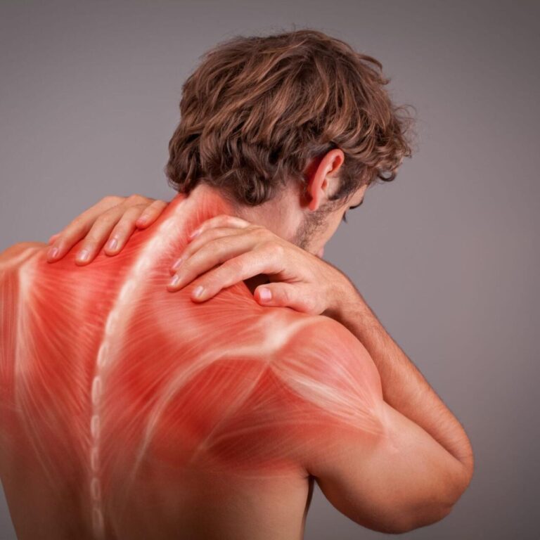 Myofasciálny bolestivý syndróm: Nový pohľad na chronickú bolesť svalov a fascie