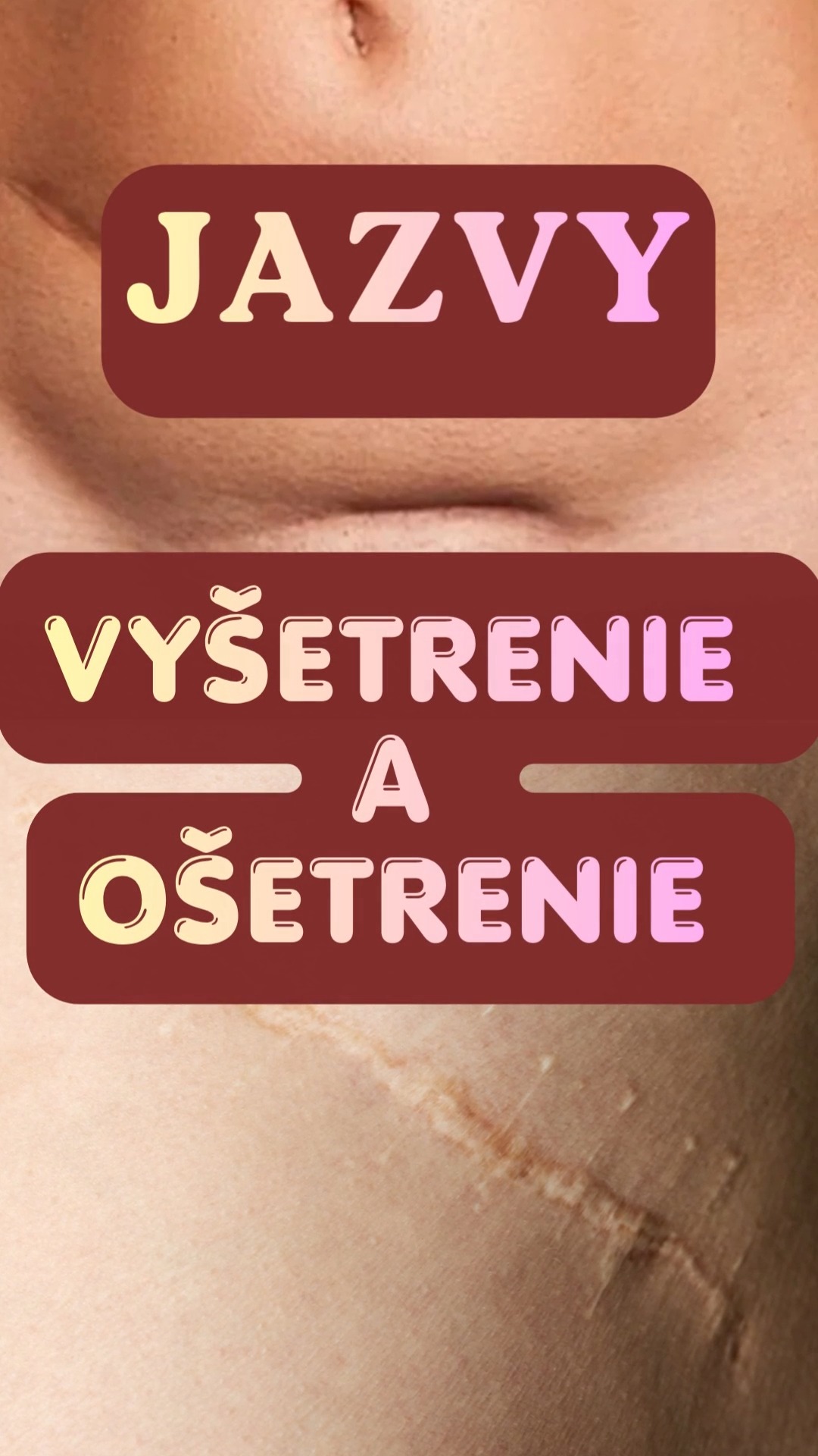 Riešenie bolesti sa môže skrývať aj vo vzdialenej oblasti, ktorá sa na prvý pohľad tvári nenápadne a nevinne.
Aj preto by správne vyšetrenie jazvy málo byť súčasťou komplexného fyzioterapeutického vyšetrenia.
Vo videu je ukážka vyšetrenia a ošetrenia jazvy priamo v našej ambulancii.
#scar #funactionfyzioterapia #fyzioterapia #jazva #vysetrenie